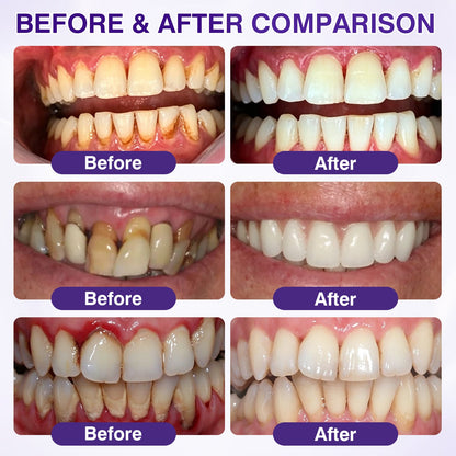 🇨🇦🎁Advanced Formula🦷Evolvion® GumRevive Periodontal Repair Gel