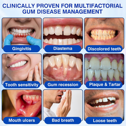 🇨🇦👨‍⚕️✅🦷Evolvion® GumRevive Periodontal Repair Gel