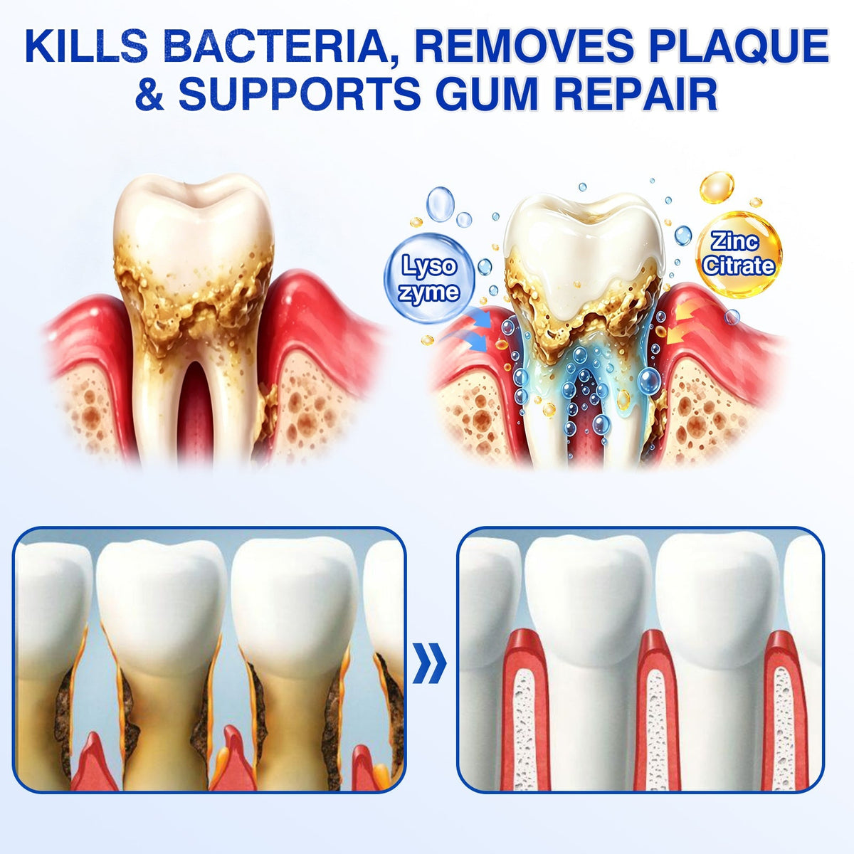🇨🇦👨‍⚕️✅🦷Evolvion® GumRevive Periodontal Repair Gel