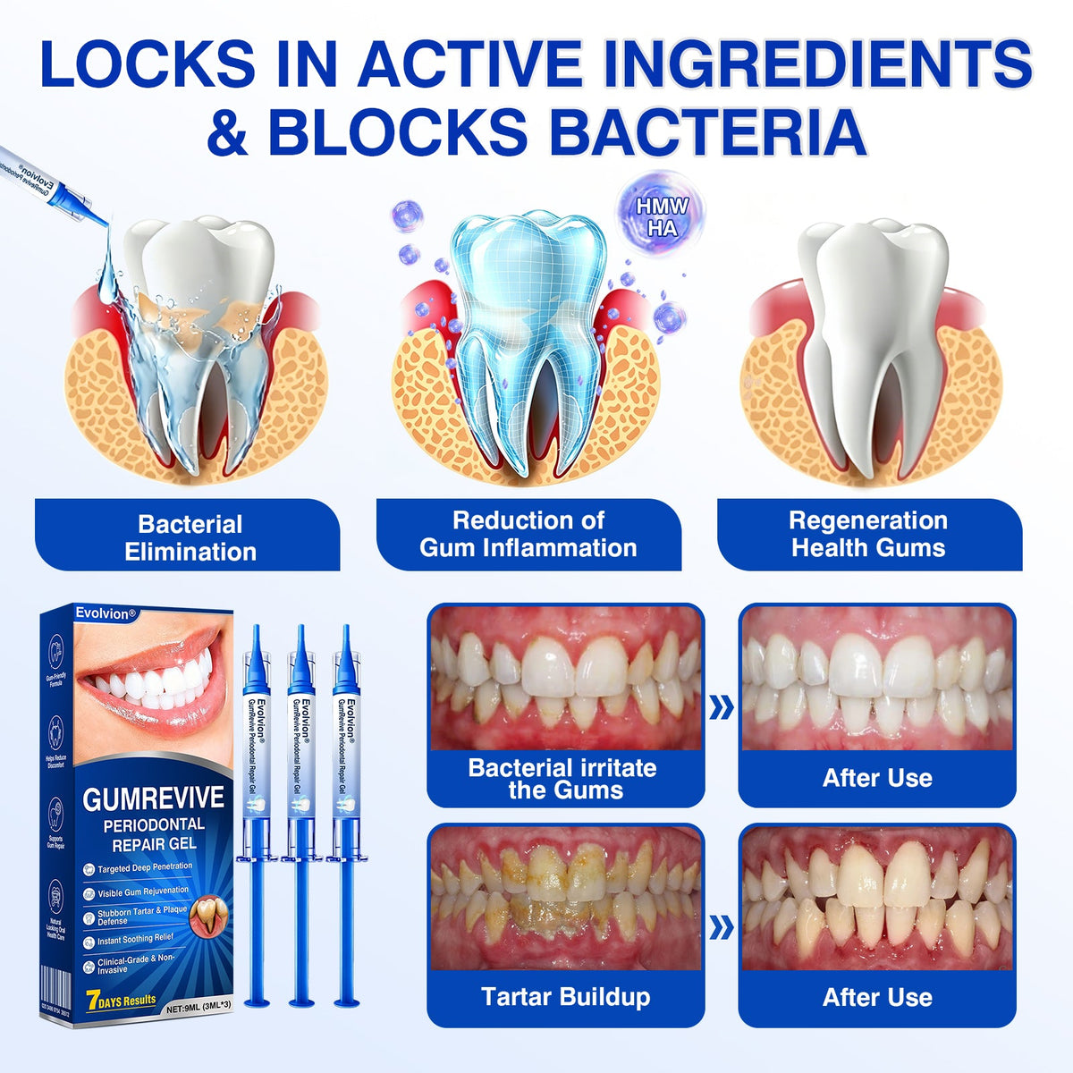 🇨🇦👨‍⚕️✅🦷Evolvion® GumRevive Periodontal Repair Gel