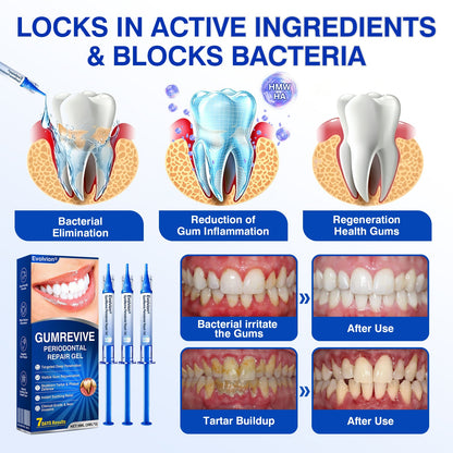🇨🇦👨‍⚕️✅🦷Evolvion® GumRevive Periodontal Repair Gel