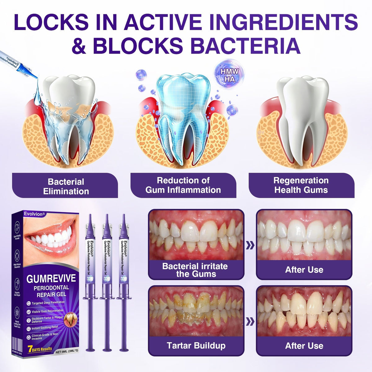 🇨🇦🎁Advanced Formula🦷Evolvion® GumRevive Periodontal Repair Gel