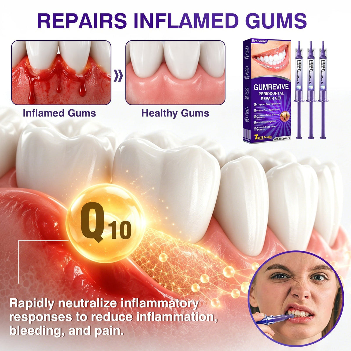 🇨🇦🎁Advanced Formula🦷Evolvion® GumRevive Periodontal Repair Gel