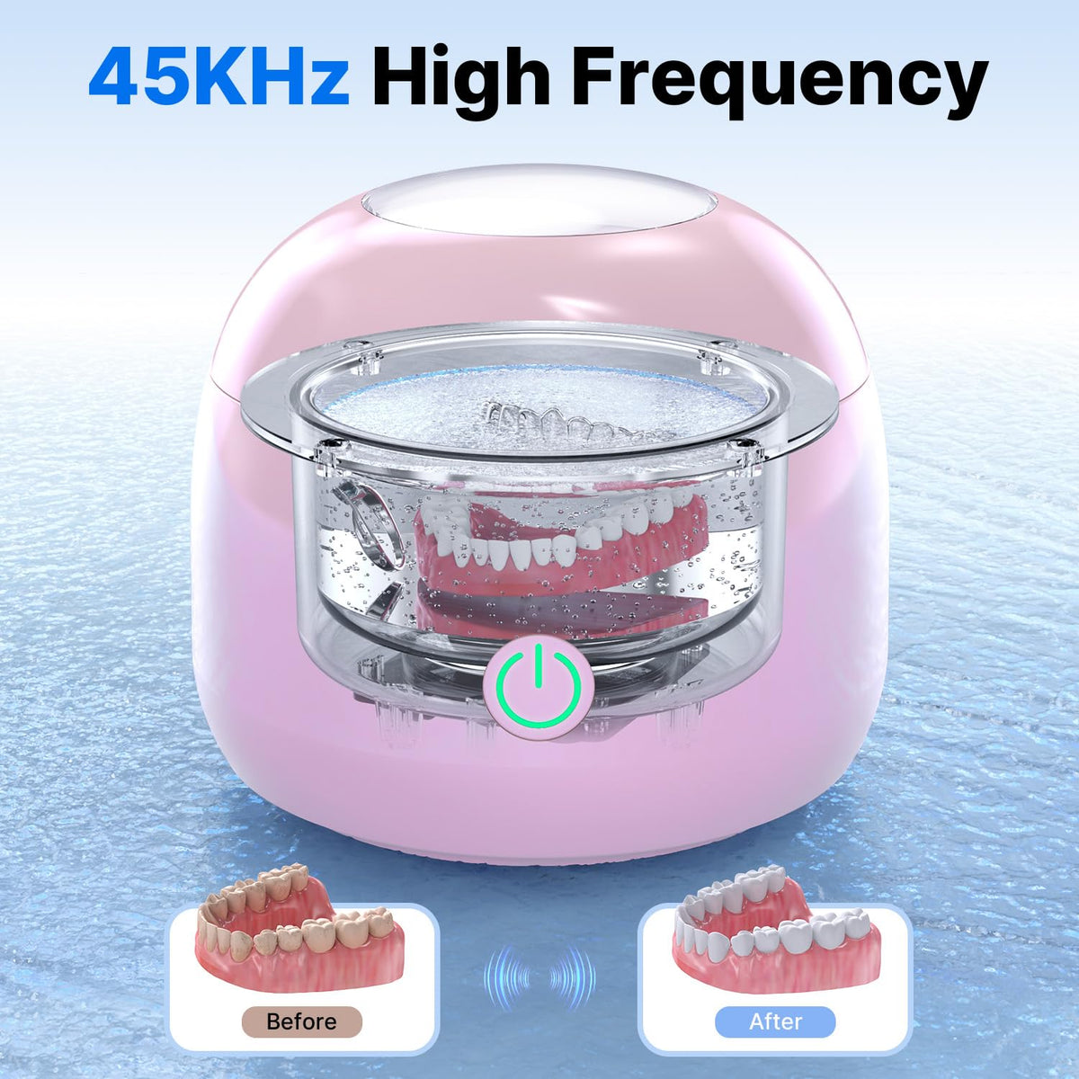 Balveruno® Ultrasonic Retainer Cleaner - UV Dental Cleaning Pod Night Guard Cleaner for Dentures, Aligner, Braces, Toothbrush Heads, Jewelry
