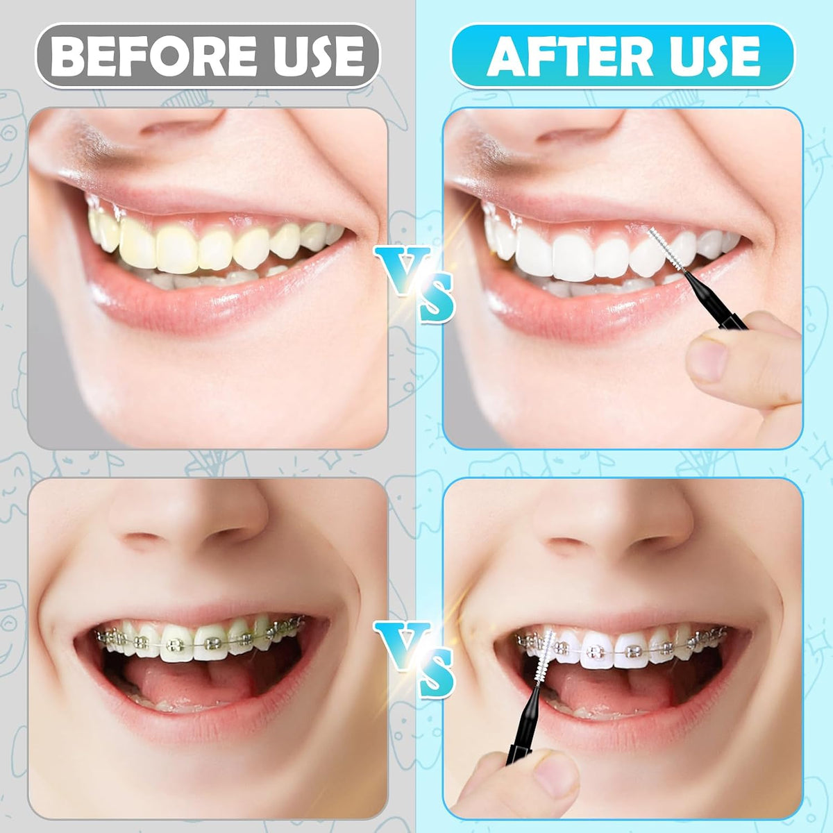 Balveruno® 120 Pieces Braces Brush Cleaner Orthodontic Flossers Toothpicks Floss Picks for Braces Kit for Teeth Cleaning Tools Spiral Dental Brush Head for Efficient Oral Care Black